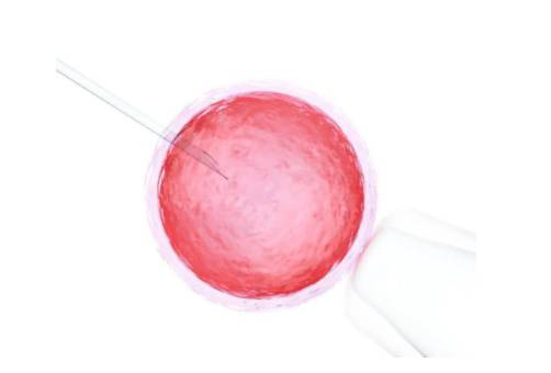 男性精子原因导致的不孕不育，做供精试管需要多少钱-